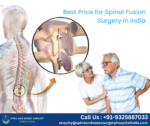 Low Cost Spinal Fusion Surgery in India