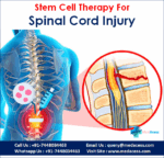 Stem Cell Therapy for Spinal Cord Injury in India