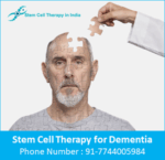 Stem Cell Therapy for Alzheimer’s in India